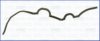 HYUNDAI 2135237500 Gasket, timing case